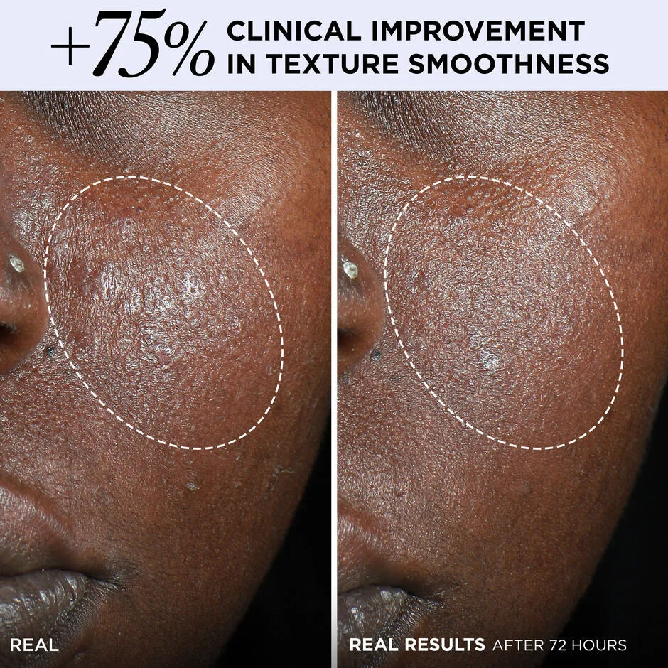 Confidence in a Cream® Barrier Boost Skin Barrier Repair Daily Moisturizer